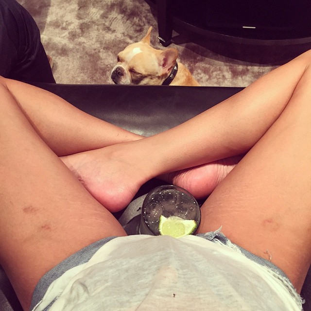 In April, Chrissy Teigen posted a photo of her stretch marks and bruises on Instagram with the caption: "Bruises from bumping kitchen drawer handles for a week. Stretchies say hi!"