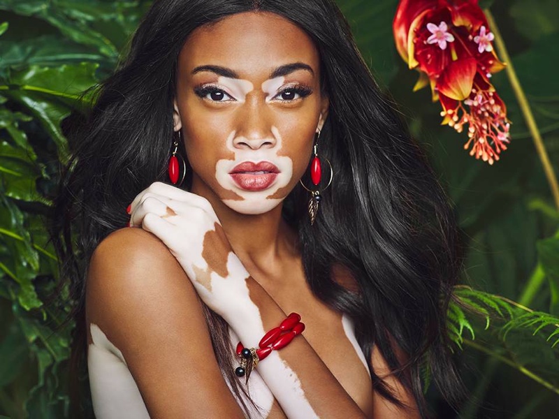 Winnie Harlow poses for Desigual's spring-summer 2015 Flower Capsule advertising campaign. 
