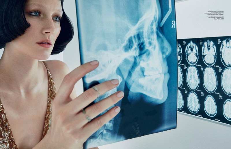 Looking at an x-ray, Josephine wears a gold Saint Laurent dress with sequins