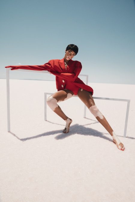 Winnie Harlow Soaks Up the Sun for ELLE Turkey Winnie Harlow Soaks Up the Sun for ELLE Turkey