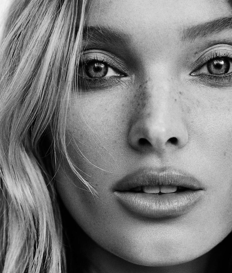 Model Elsa Hosk shows off her freckles in a black and white image