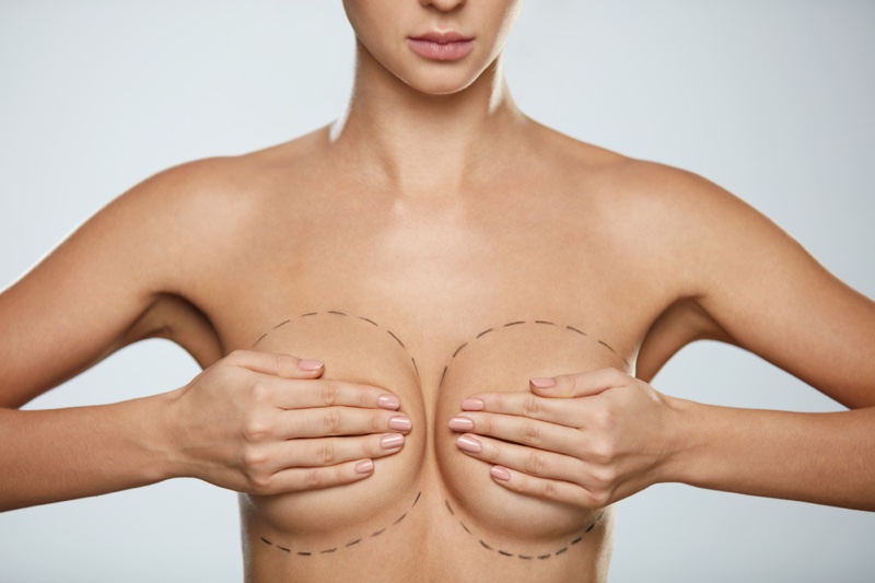 Model Breast Augmentation Markings Topless