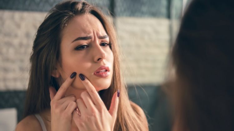 10 Tips to Help Fight Acne Young Woman Worried Skin Breakout