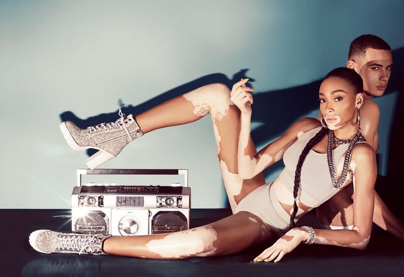 An image from Winnie Harlow x Steve Madden's spring 2020 advertising campaign