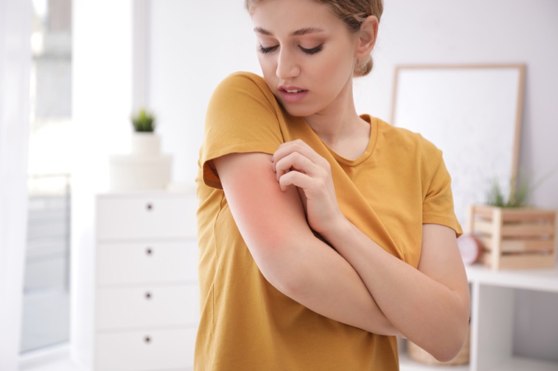 Woman Touching Rash Arm