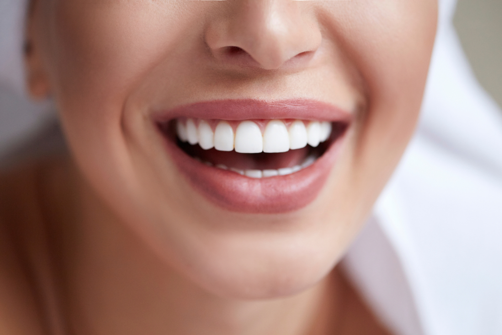 Closeup Model White Teeth