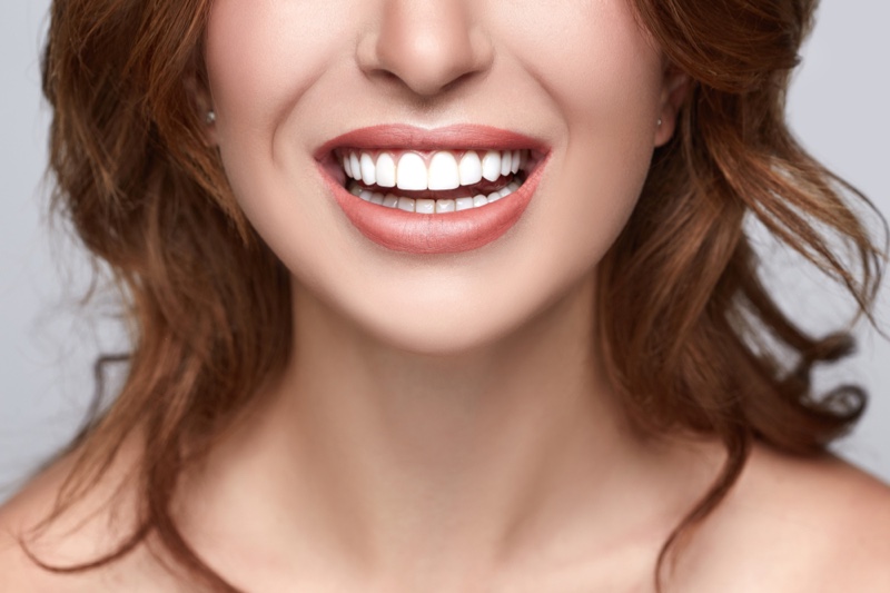 Closeup Womans Teeth Smile Veneers