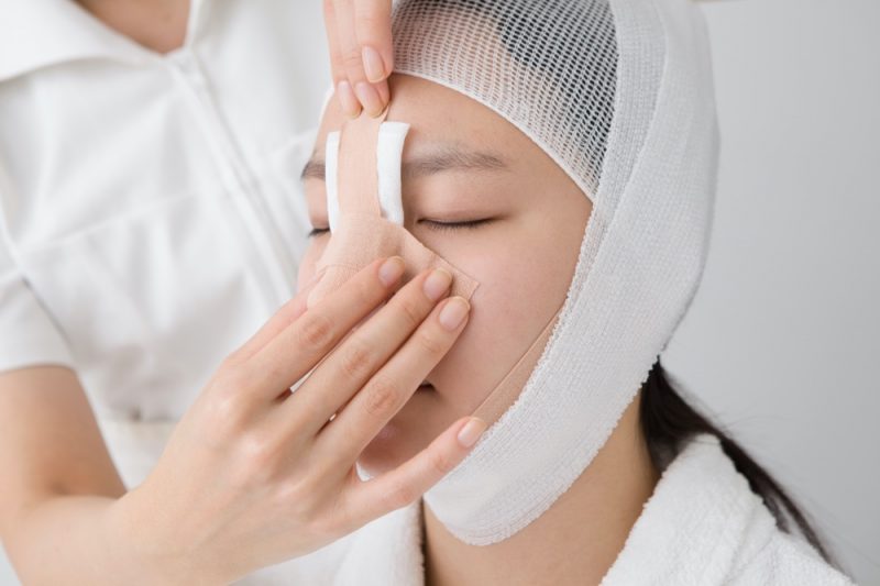 Asian Woman Nose Job
