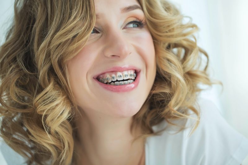 Woman Smiling Braces