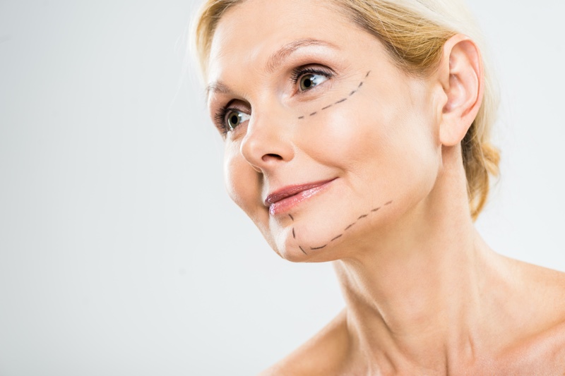 Older Woman Cosmetic Surgery Lines Face