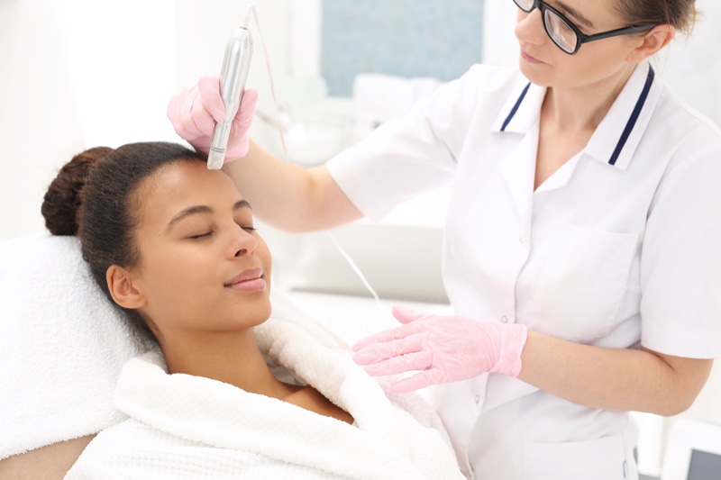 Microneedling Treatment