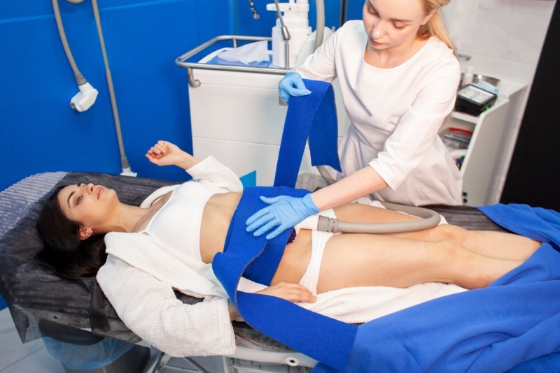 Woman Coolsculpting Stomach
