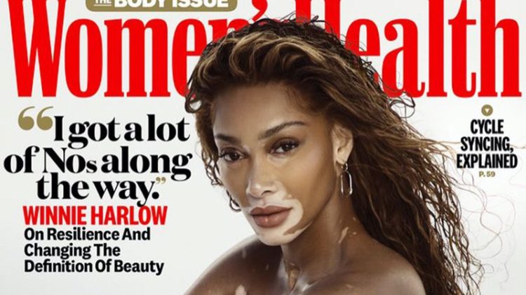 Winnie Harlow Strips Down for Women’s Health Cover Story