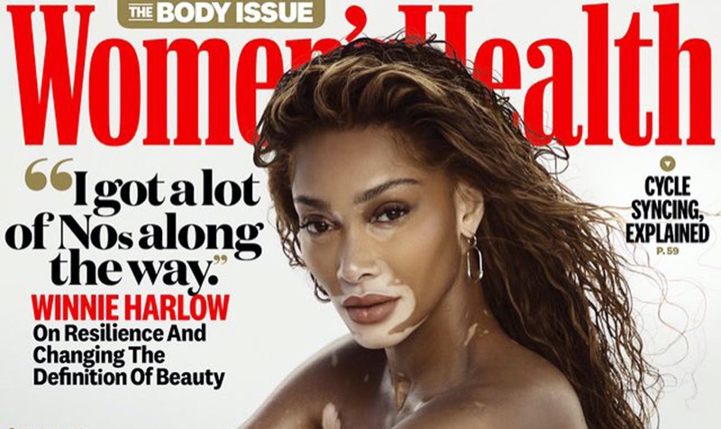 Winnie harlow womens health 2023