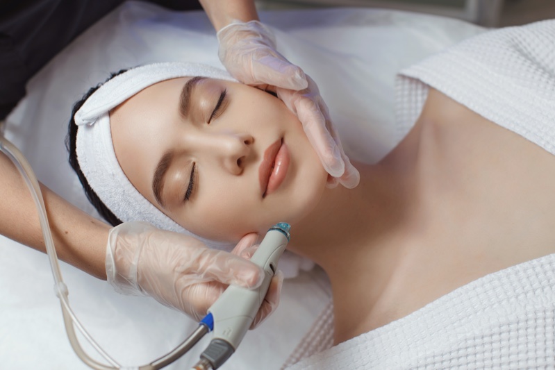 Microneedling