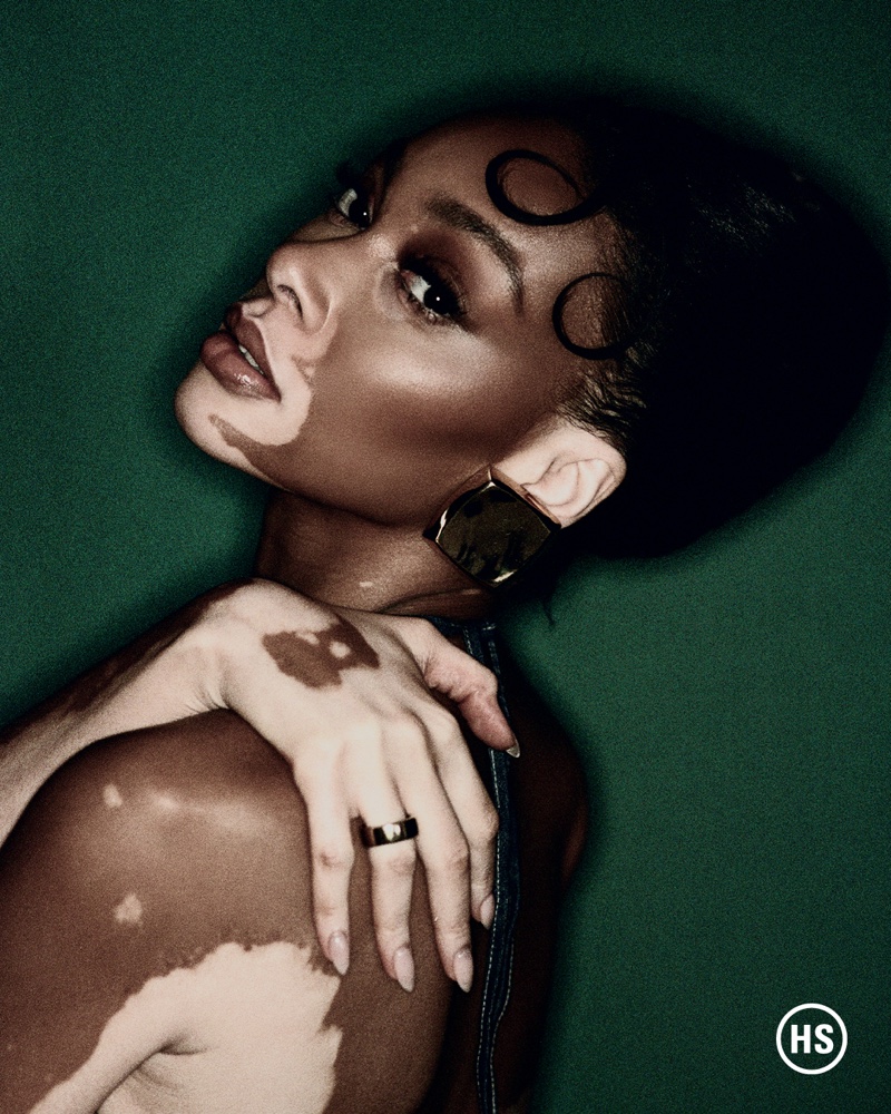 Showing off her striking features, Winnie Harlow takes the spotlight.